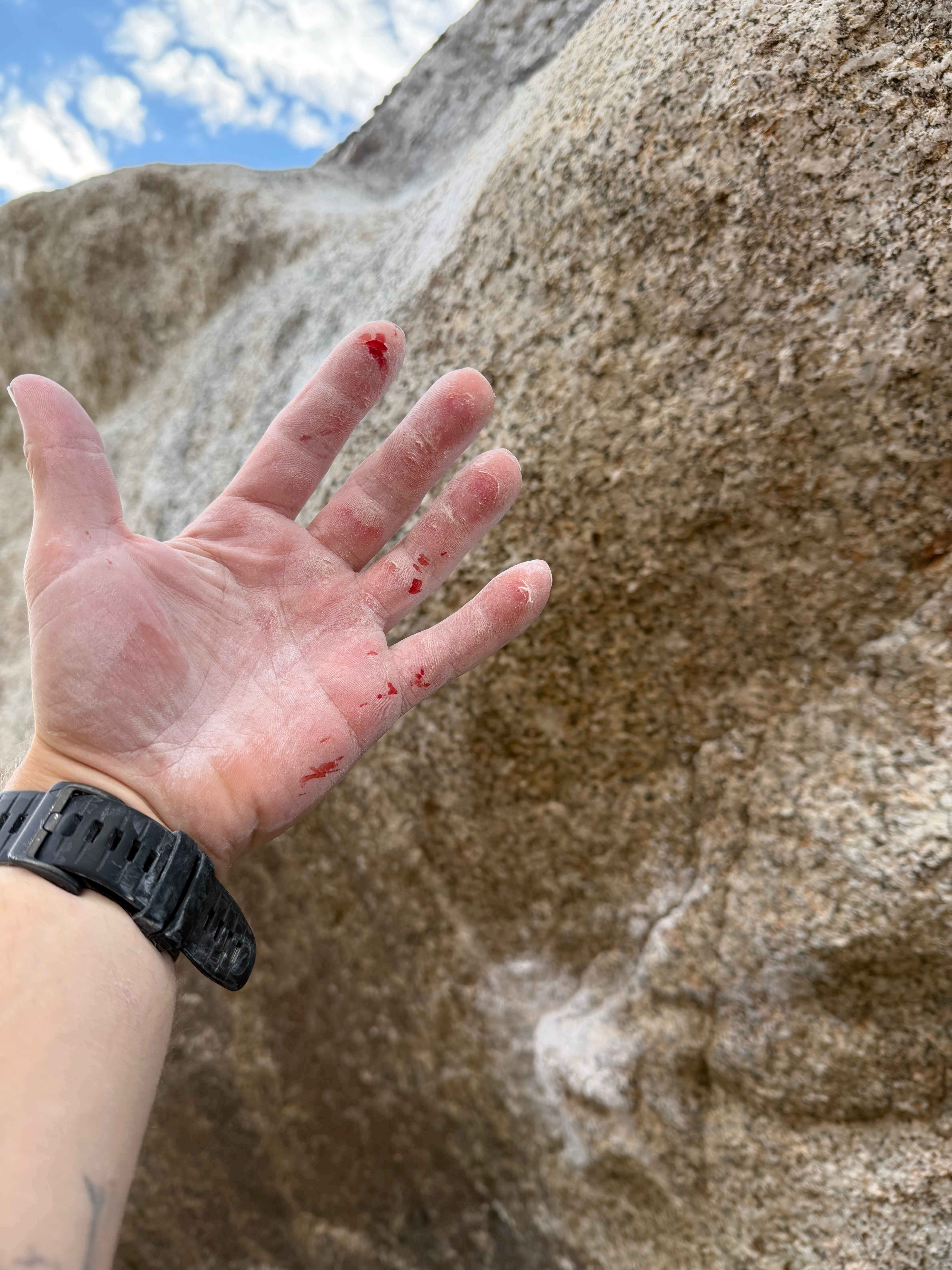 Bloodied Open Hand Grip